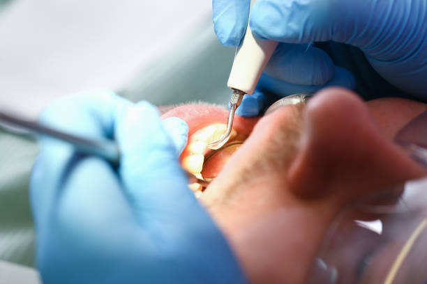 Best Broken or Chipped Tooth Repair in Northlake, IL
